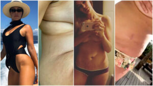 8 celebrity mamas who are PROUD to show off their stretch marks!